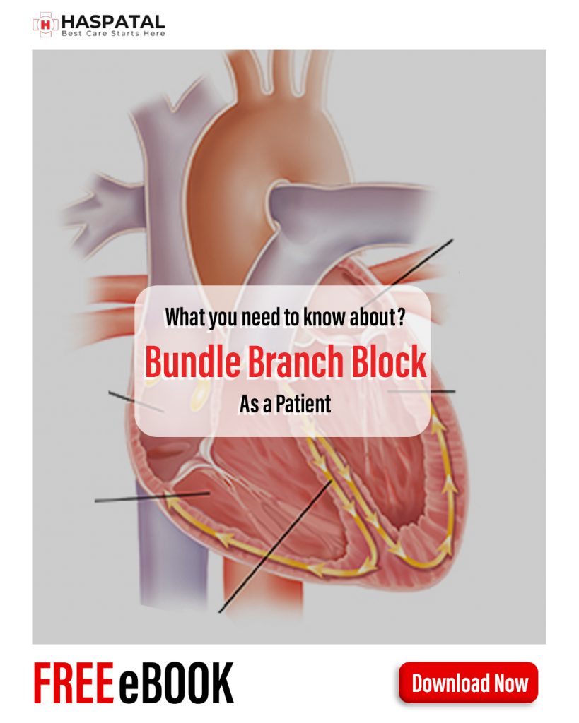 How bundle branch block can affect your health? Haspatal online doctor consultation app